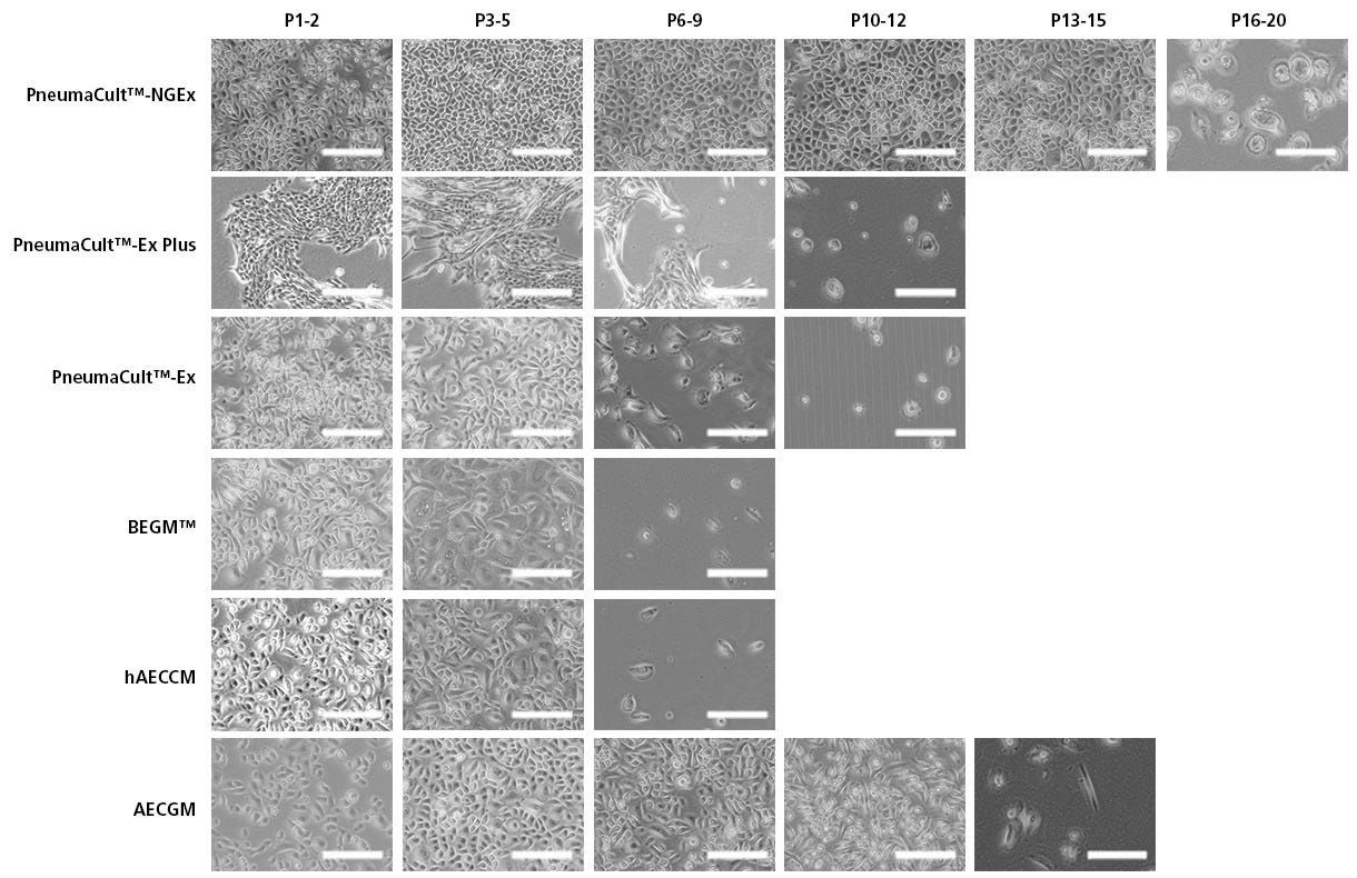 PneumaCult™-NGEx Enables Extended Passages Without Compromising Morphological Integrity Compared to Other Expansion Media.